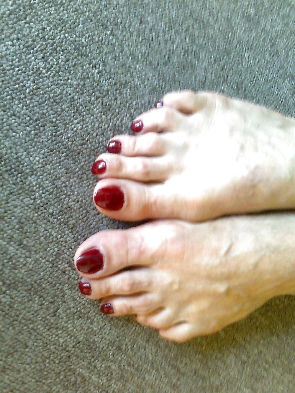 25P Toenails
