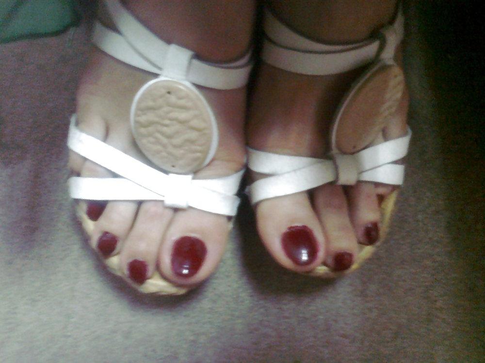 25P Toenails