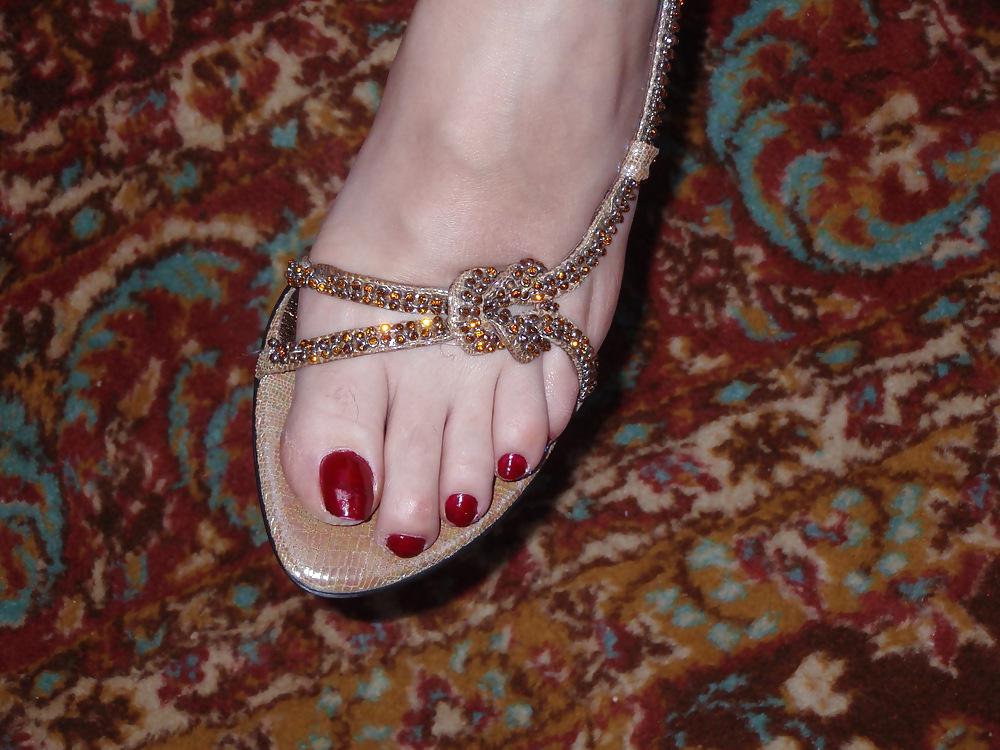 25P Toenails