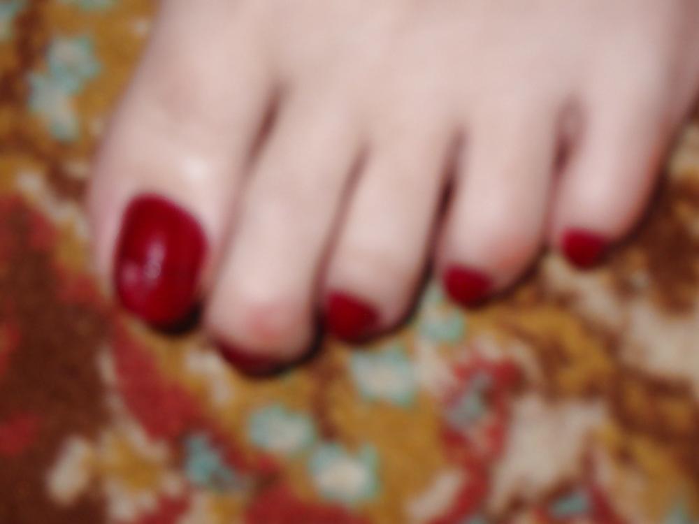 25P Toenails