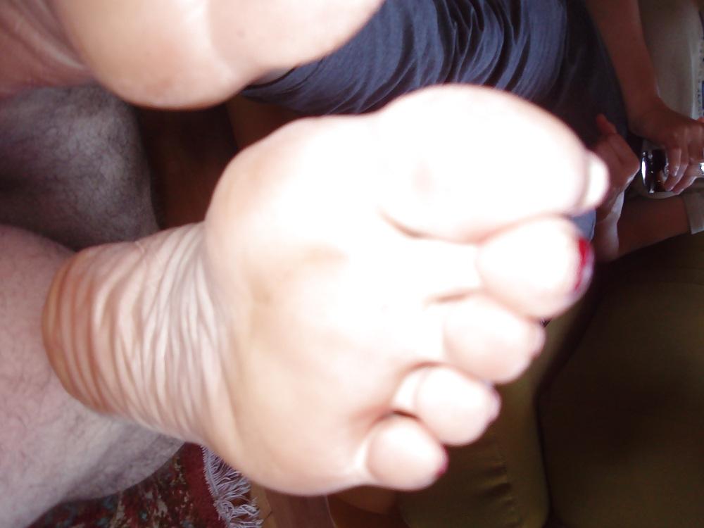 25P Toenails