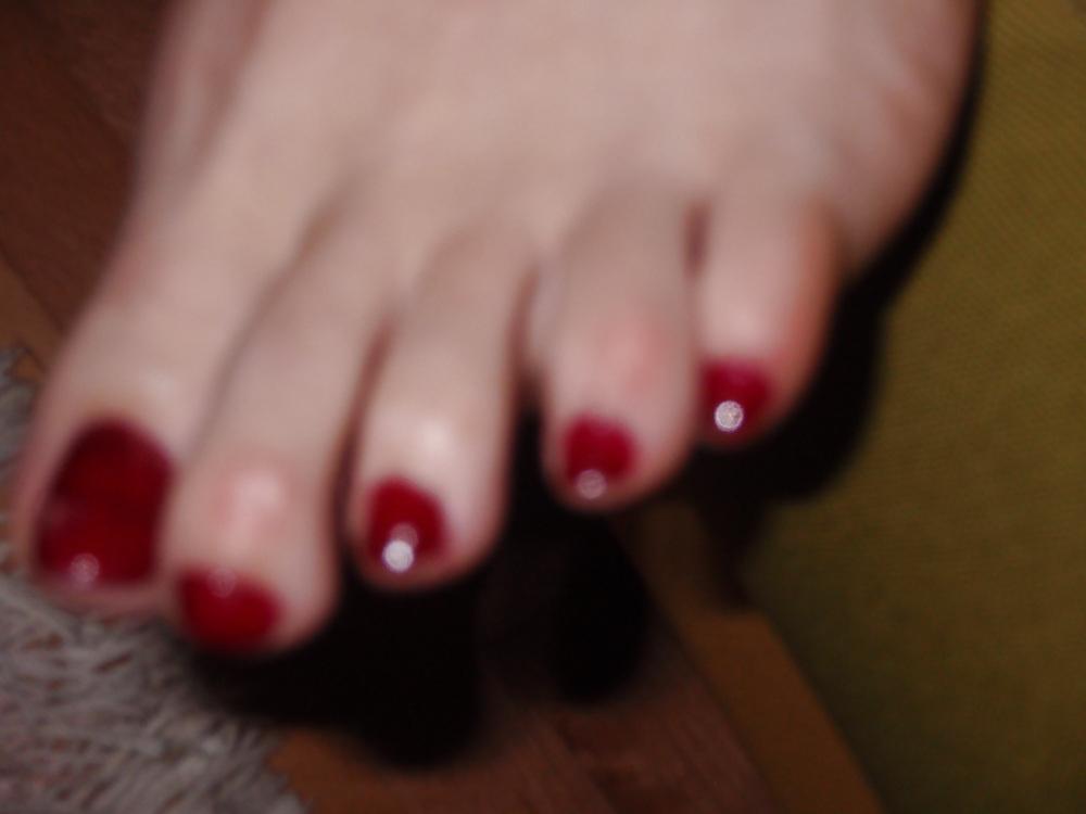 25P Toenails