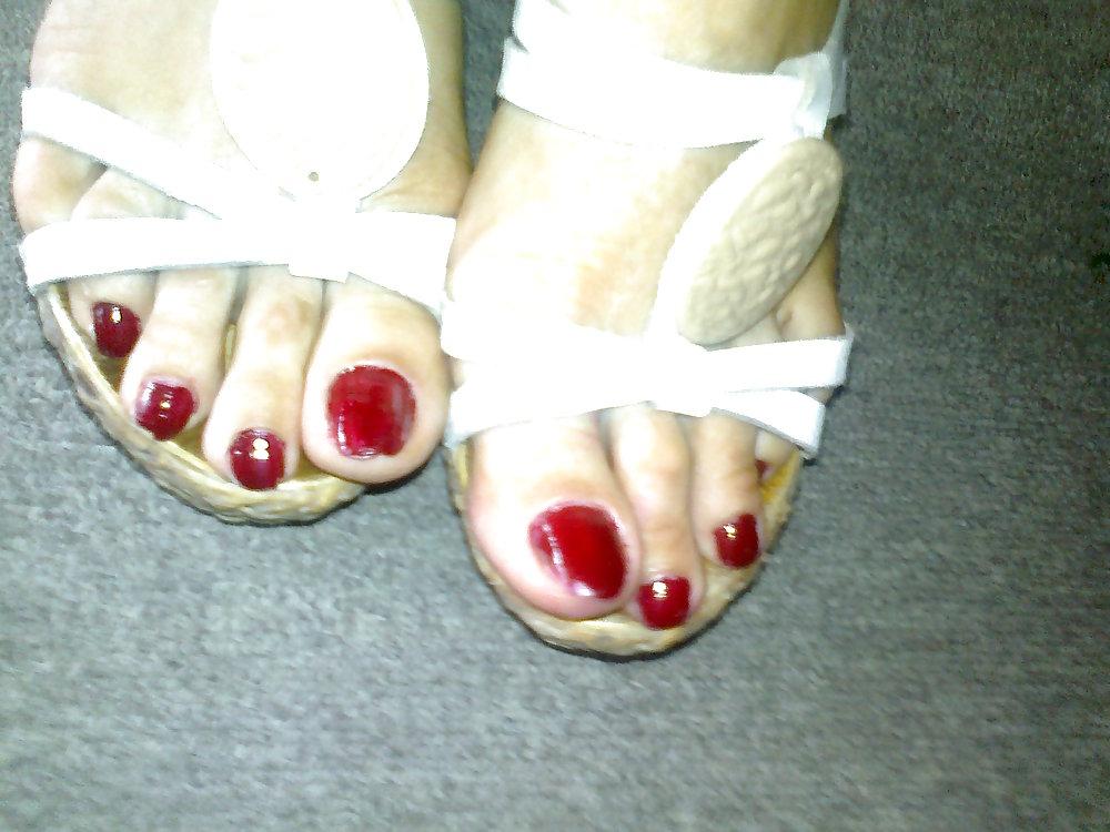 25P Toenails