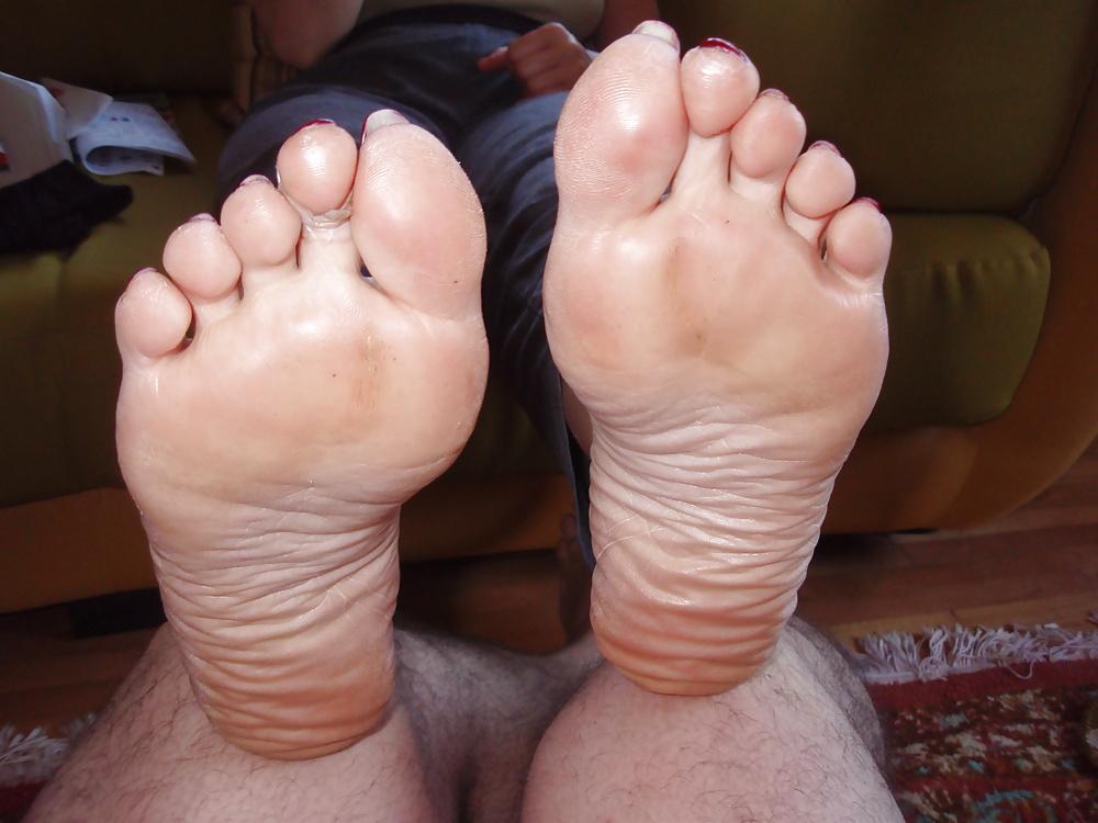 25P Toenails