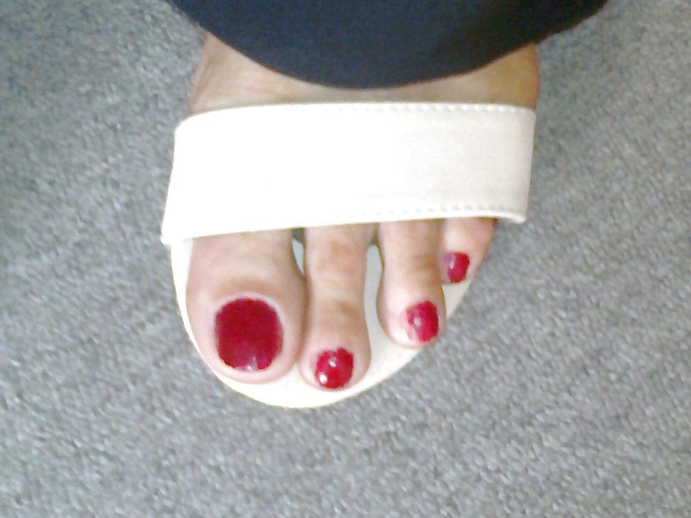 25P Toenails