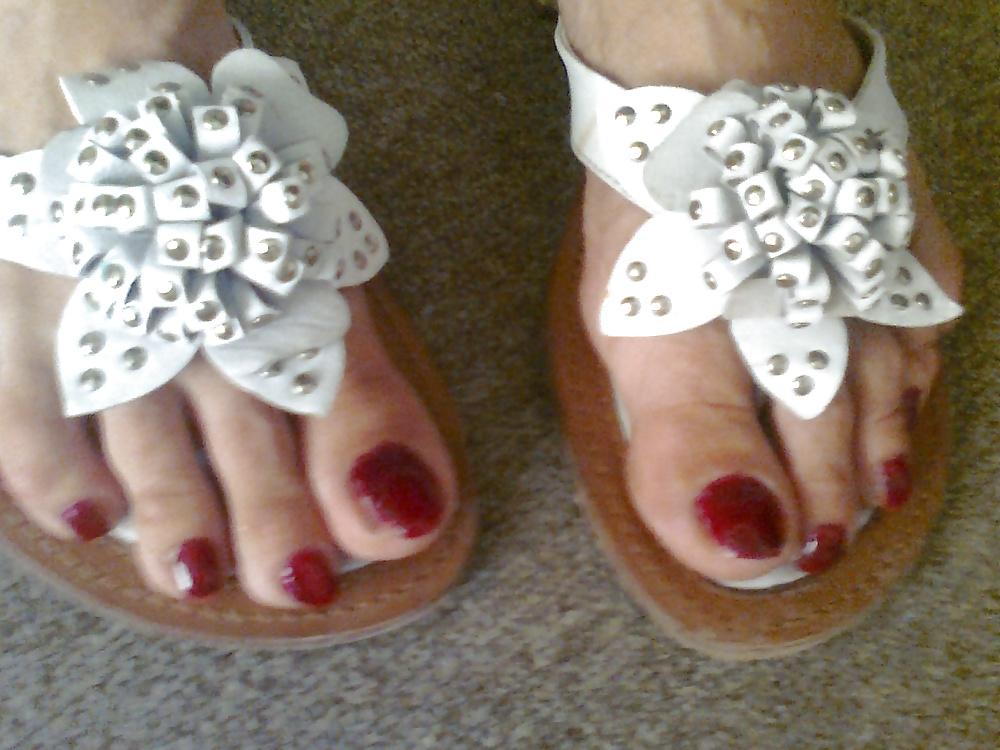 25P Toenails