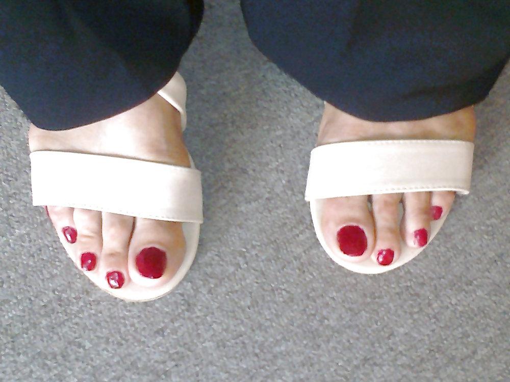 25P Toenails
