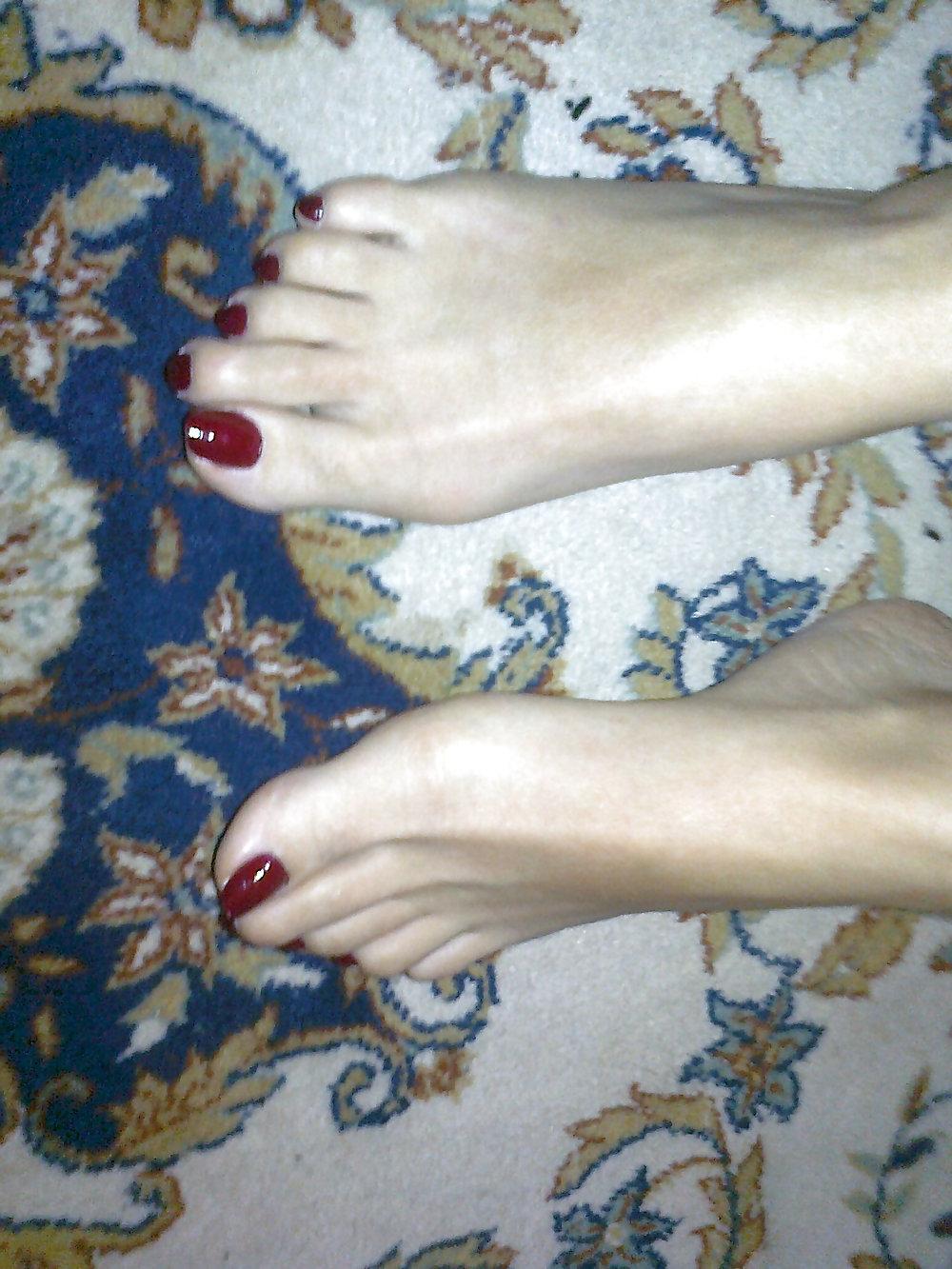 25P Toenails