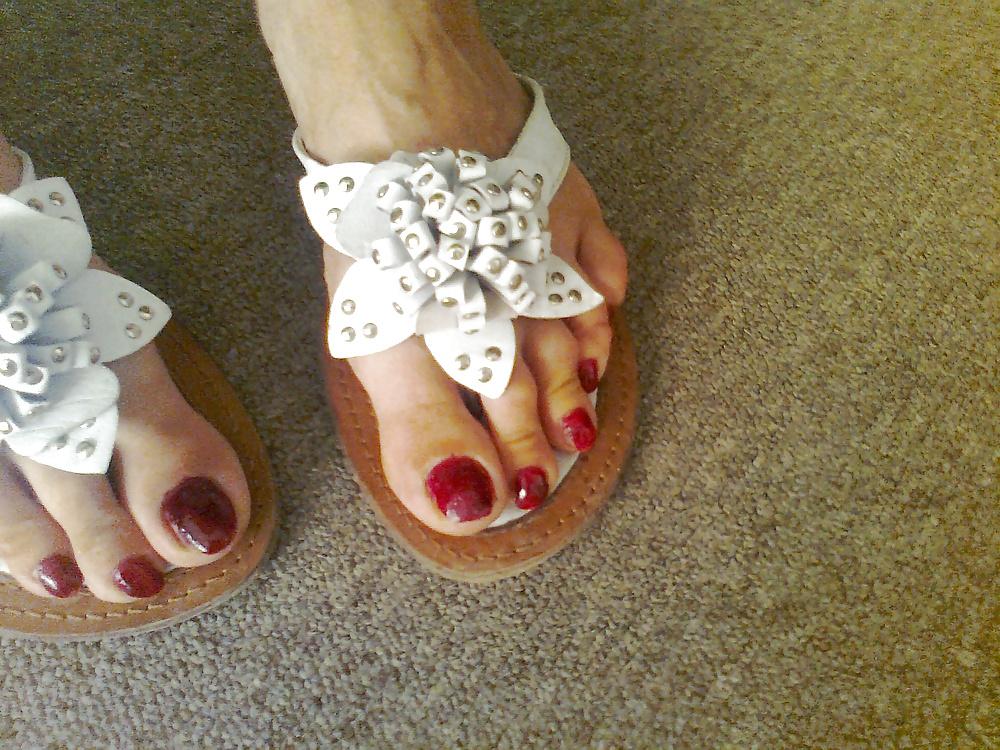 25P Toenails