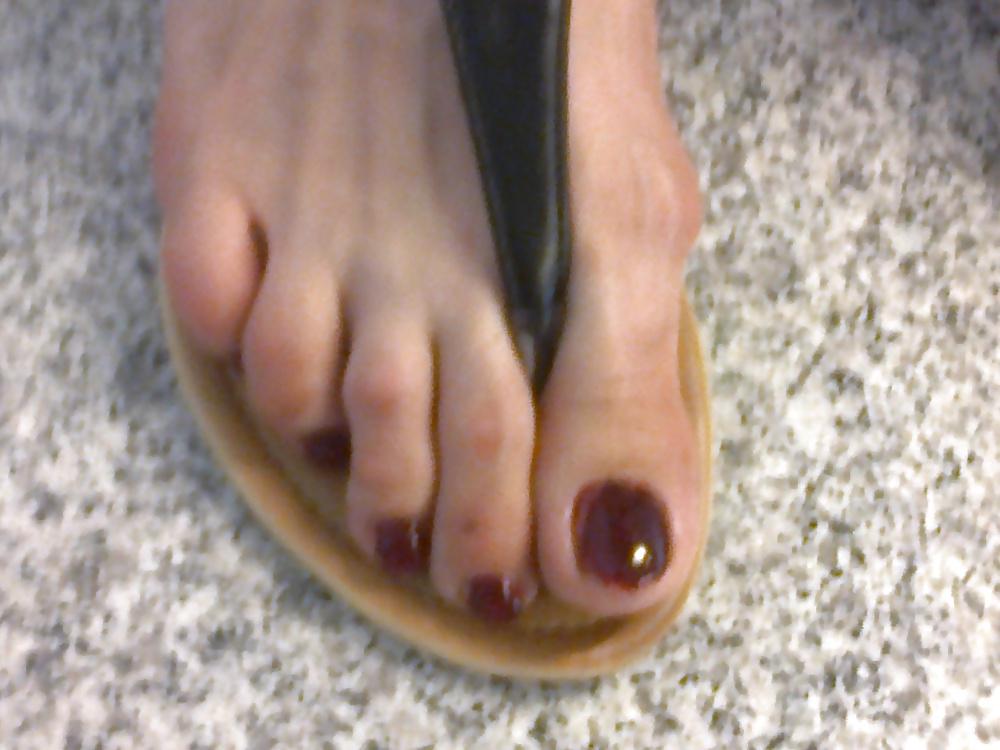 25P Toenails