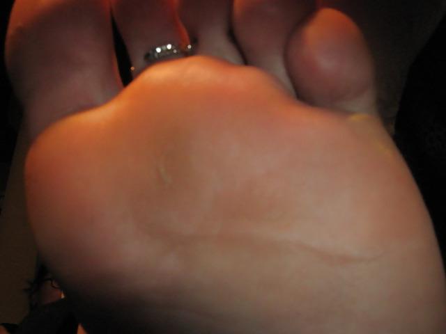 12P EX. GF feet