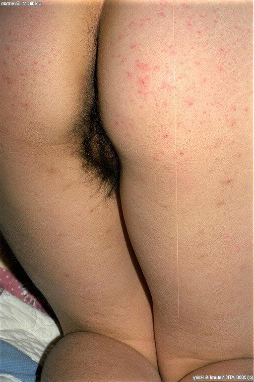 16P Amateur slant-eyed model Amanda shows hair all over her naked body