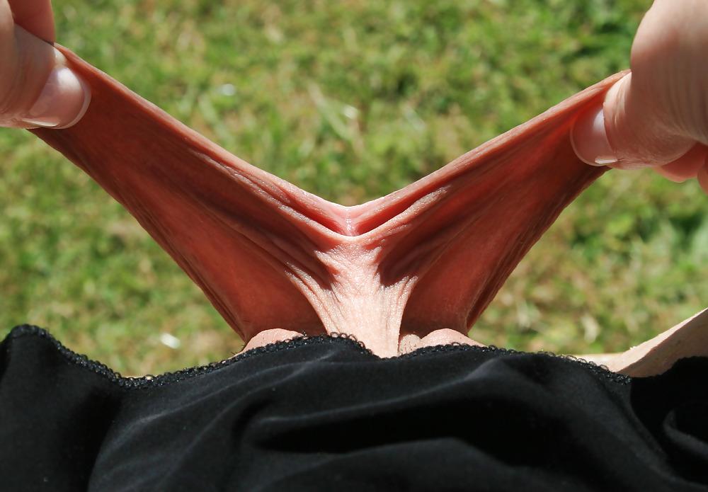 25P Extrem grosse Schamlippen 1