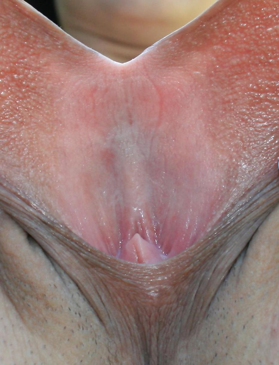 25P Extrem grosse Schamlippen 1