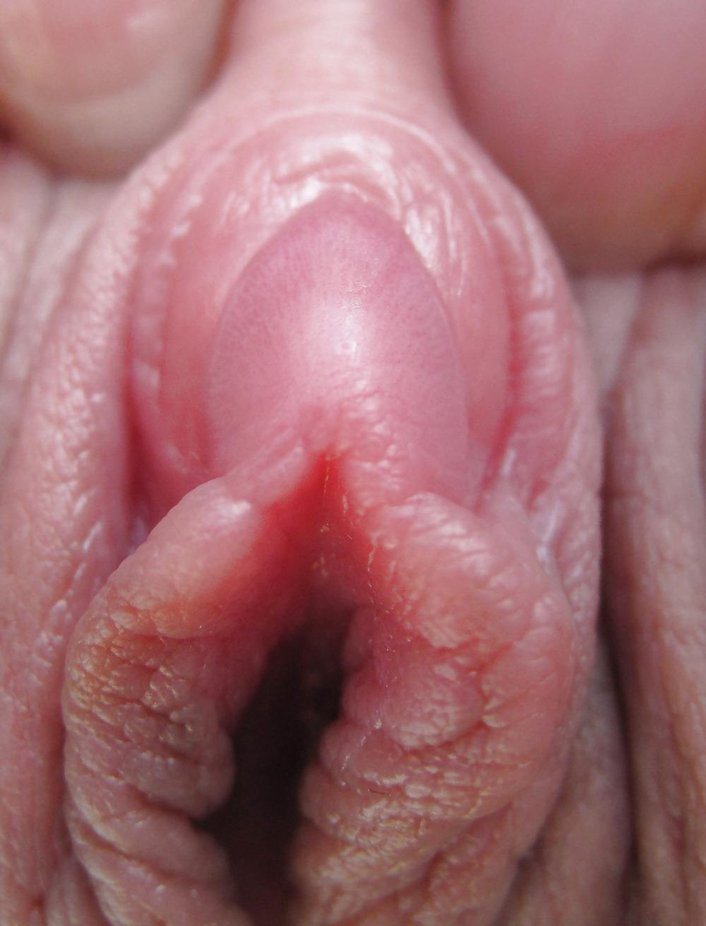 25P Extrem grosse Schamlippen 1
