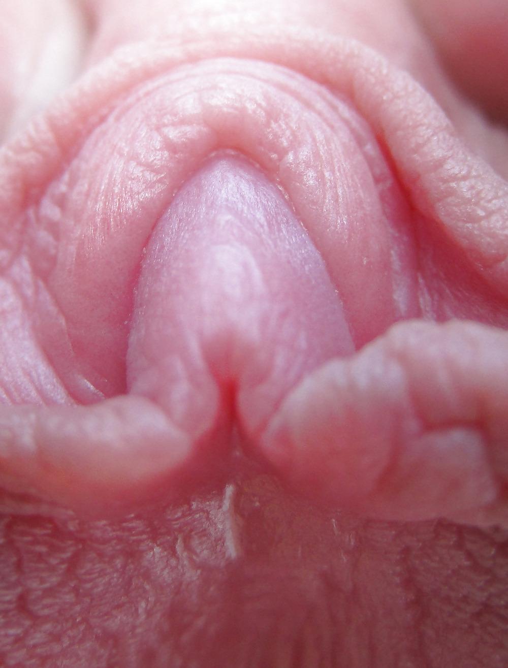 25P Extrem grosse Schamlippen 1