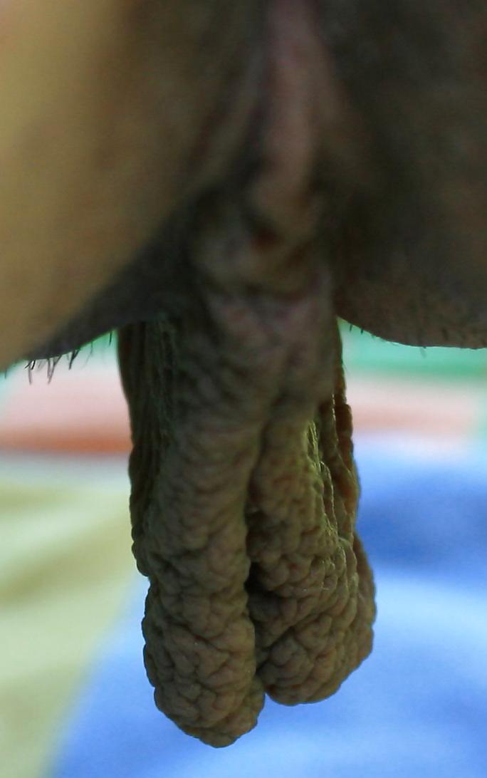 25P Extrem grosse Schamlippen 5