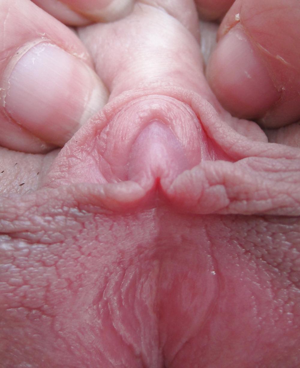 25P Extrem grosse Schamlippen 5