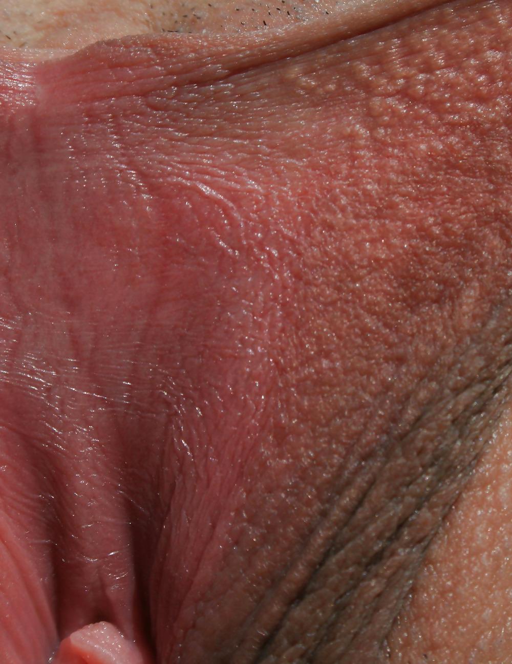 25P Extrem grosse Schamlippen 5