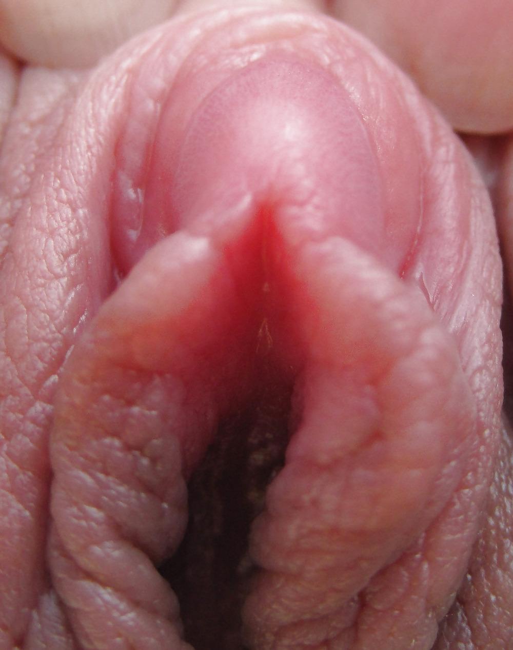 25P Extrem grosse Schamlippen 5