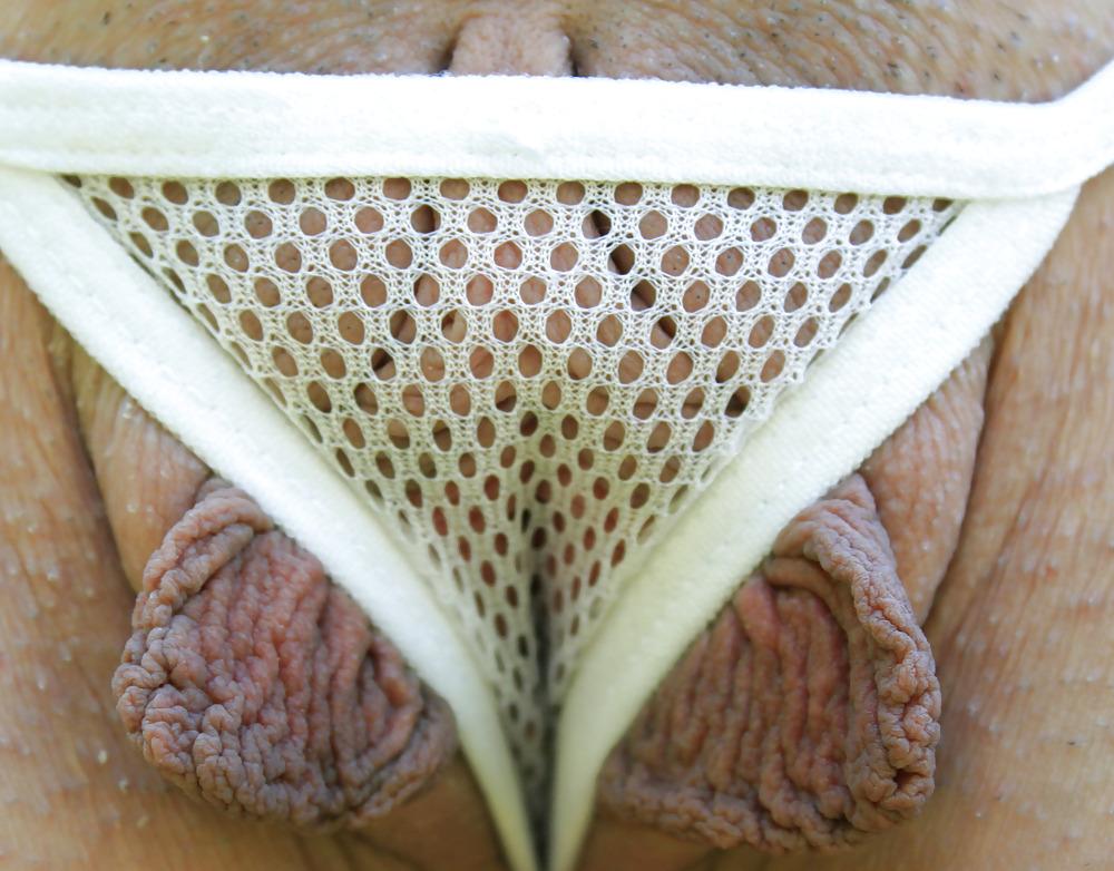 25P Extrem grosse Schamlippen 5