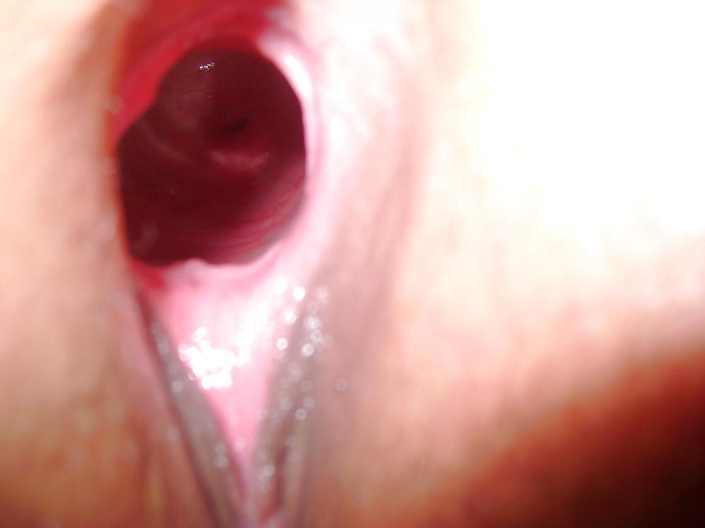 5P Some more native gaping  pussy 