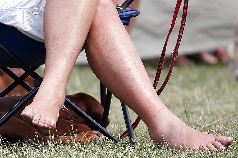 15P Voyeured feet and legs at dog show