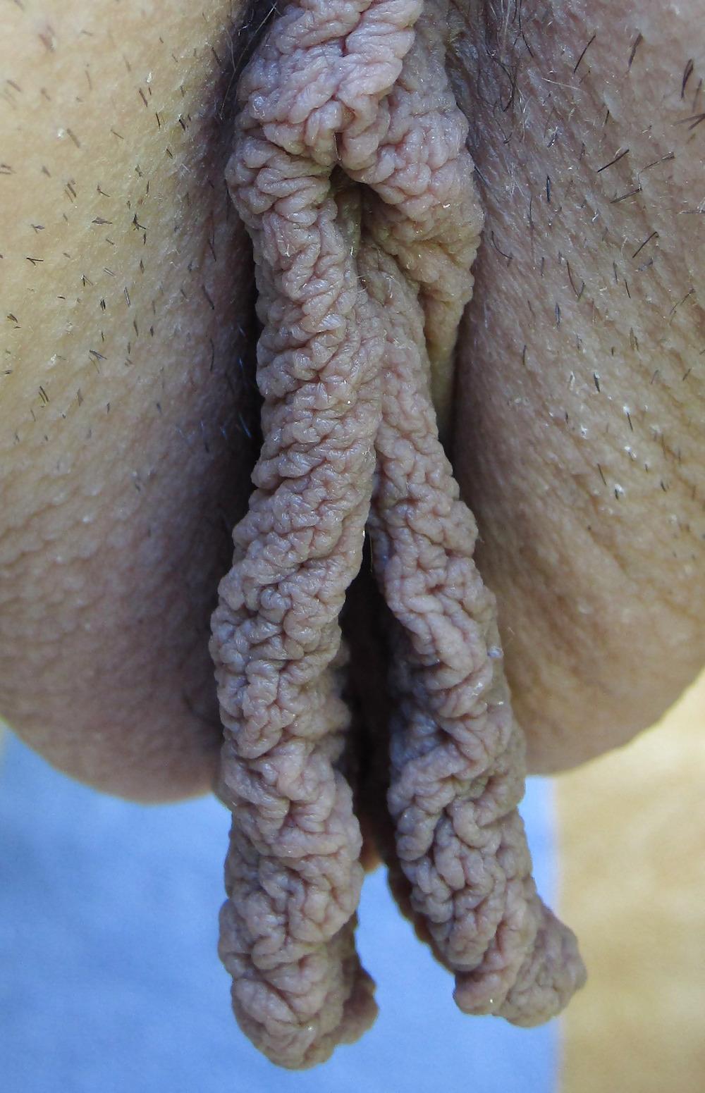 25P Extrem grosse Schamlippen 3