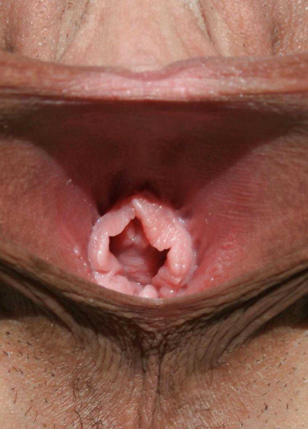 25P Extrem grosse Schamlippen 3