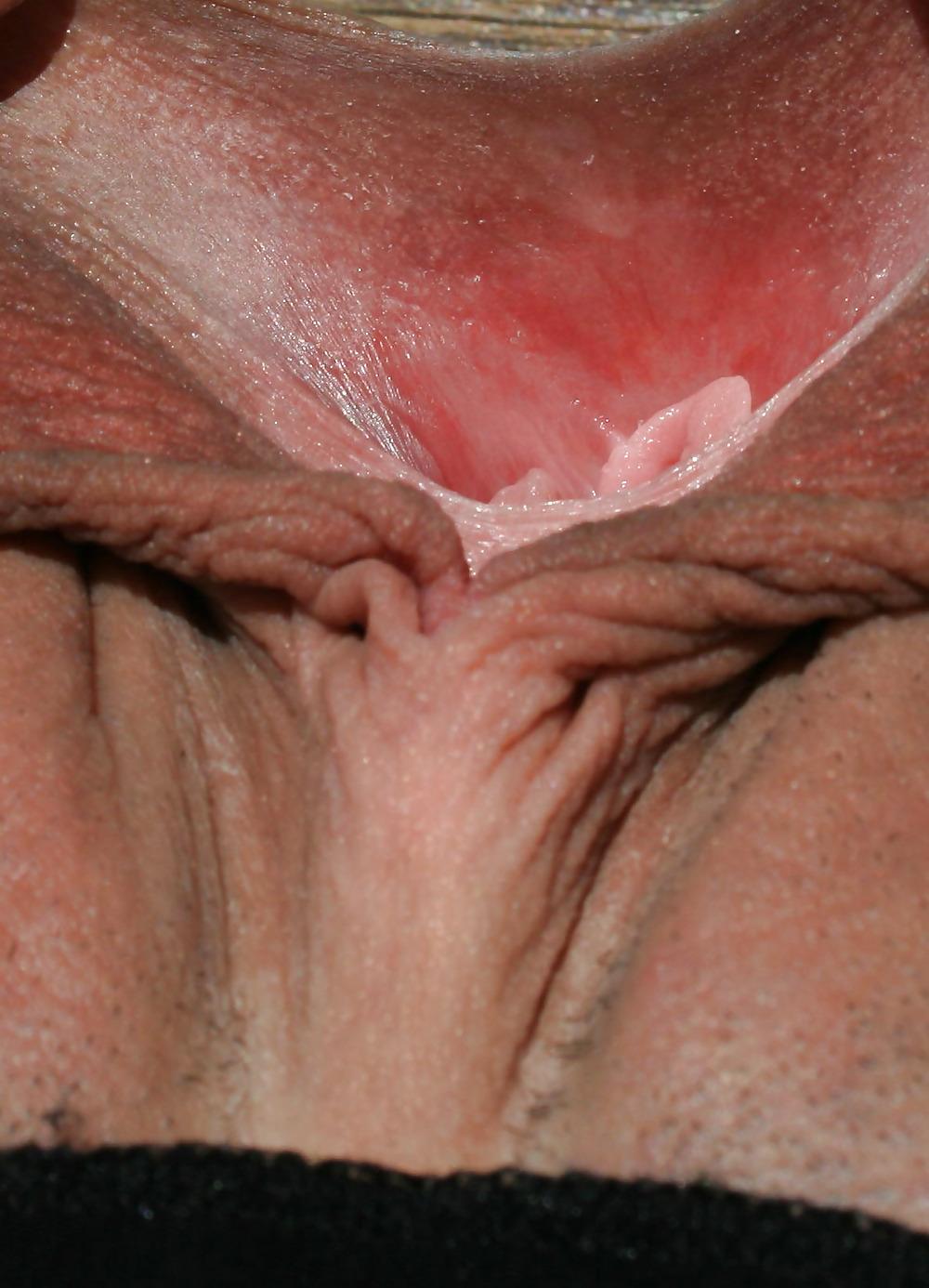 25P Extrem grosse Schamlippen 3