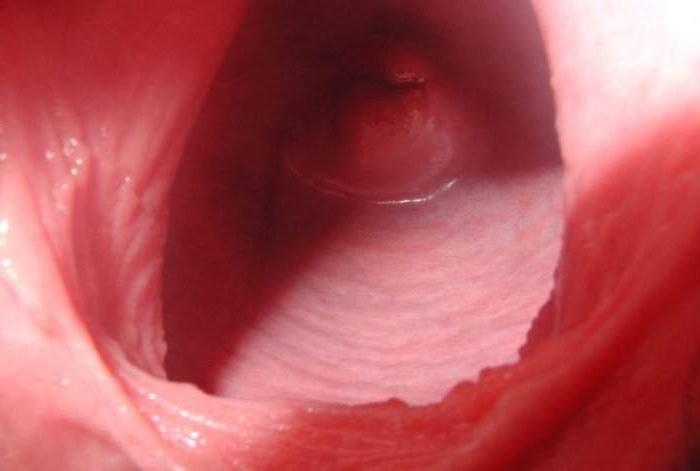 16P Pussy unbounded