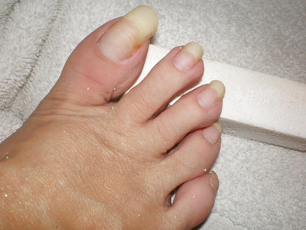 23P Hot long toe nalis
