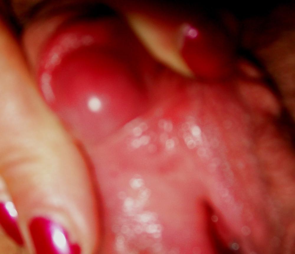 19P Growing CLIT and lips like sugar