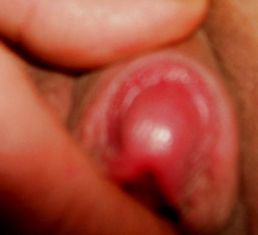 19P Growing CLIT and lips like sugar