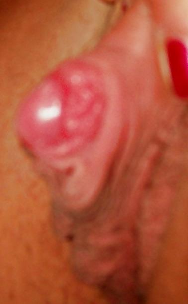 19P Growing CLIT and lips like sugar
