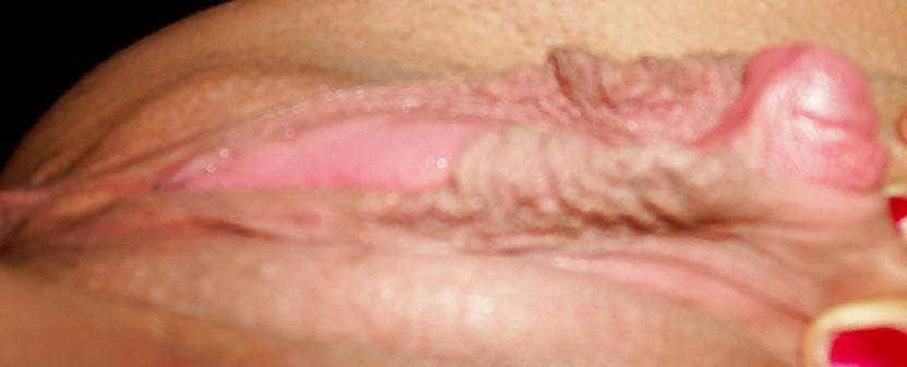 19P Growing CLIT and lips like sugar