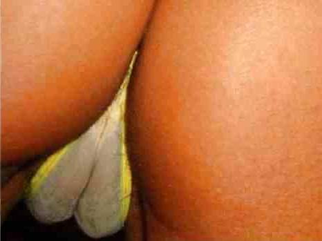 25P Cameltoes