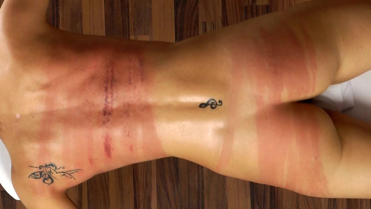 20P Female corporal punishments and judicial spanking