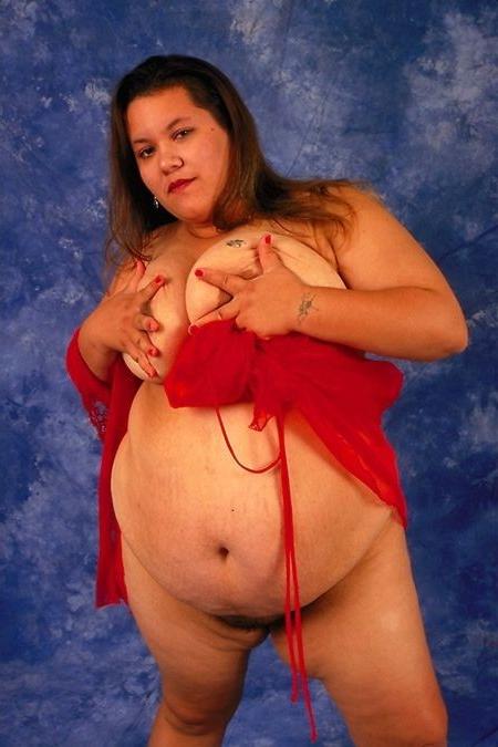 17P Giant belly fatty changes dress
