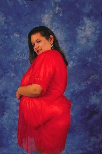 17P Giant belly fatty changes dress