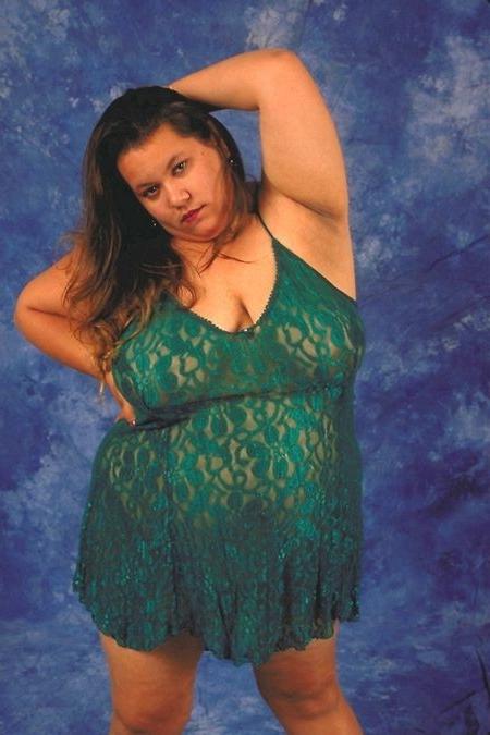 17P Giant belly fatty changes dress