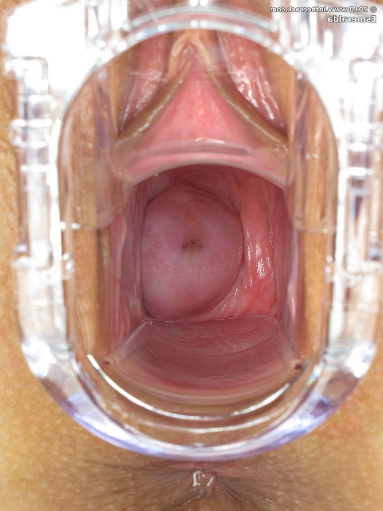 15P Babe fingers asshole n spreads pussy with speculum