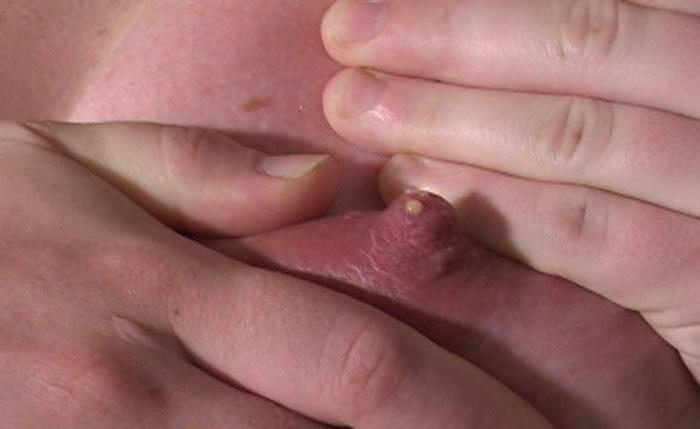 20P Teen begs a dude to cum allover her pregnant belly