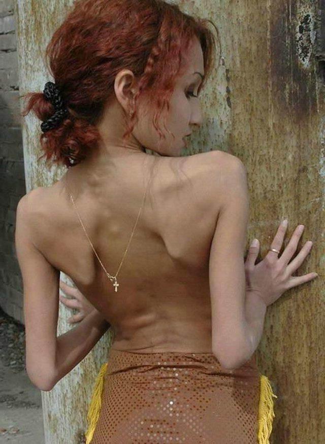 15P Skinny Hottie