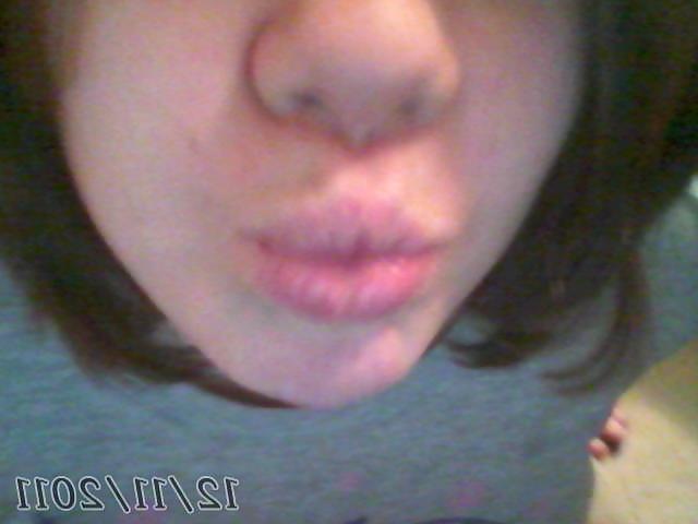 14P Close up 