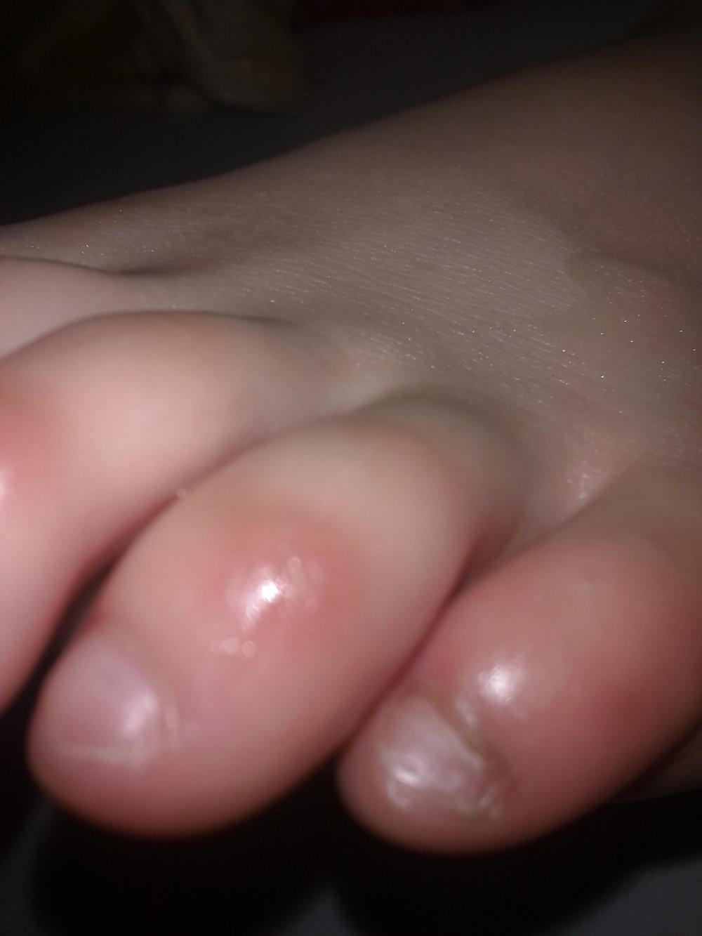 16P Foot action 1