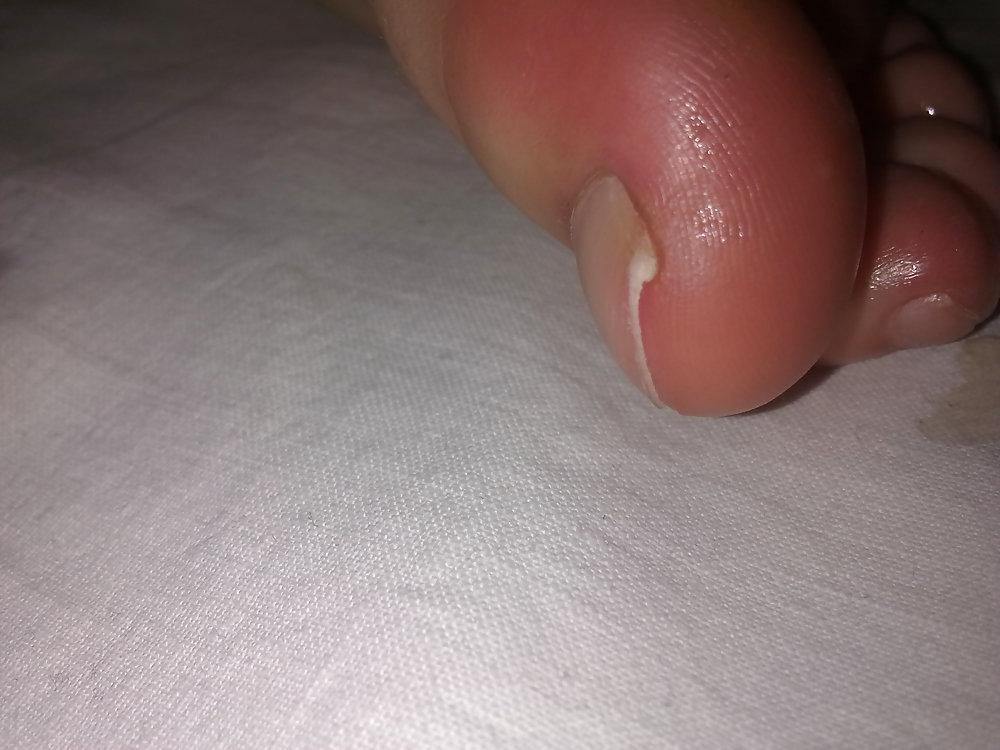 16P Foot action 1
