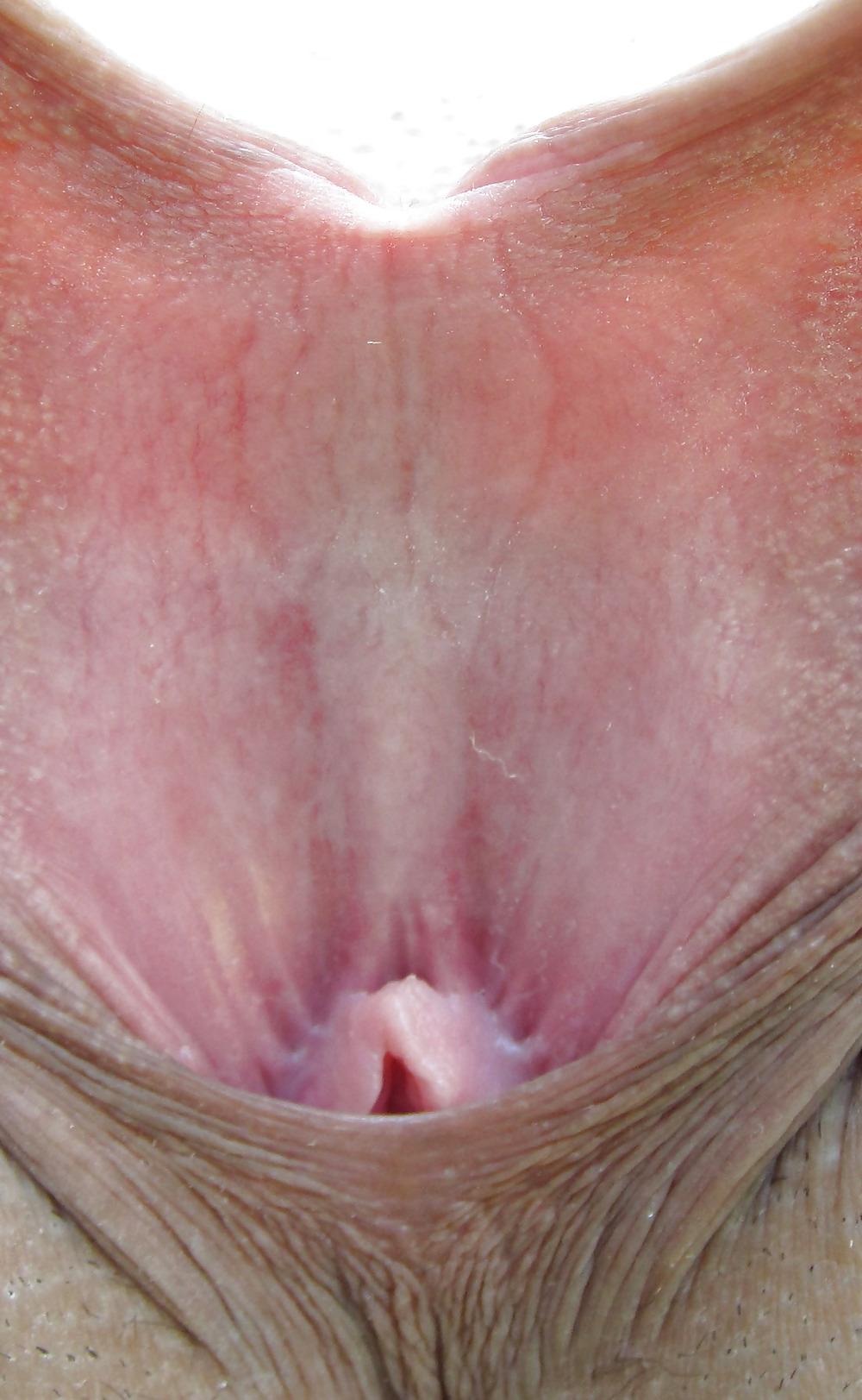 25P Extrem grosse Schamlippen 4