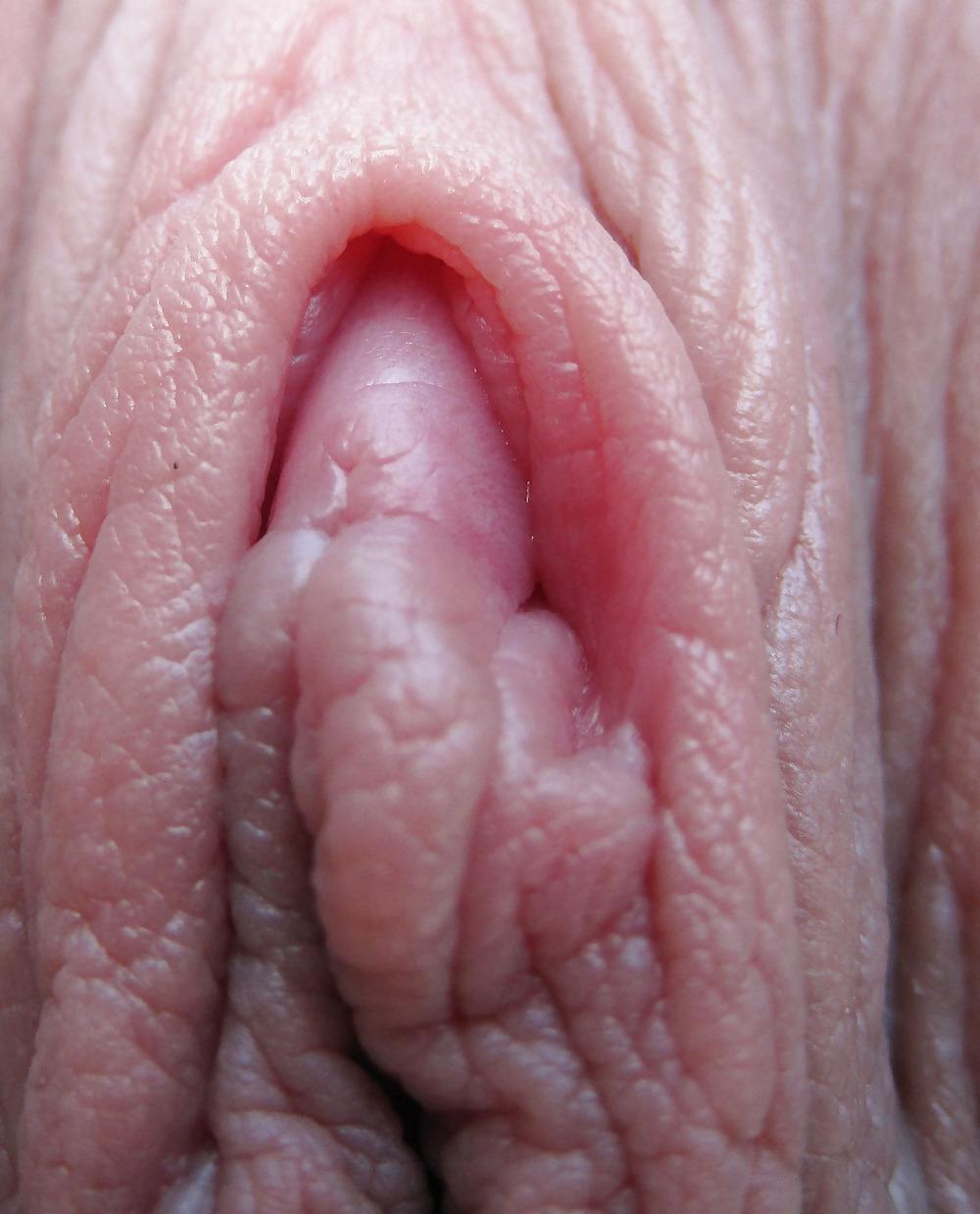 25P Extrem grosse Schamlippen 4