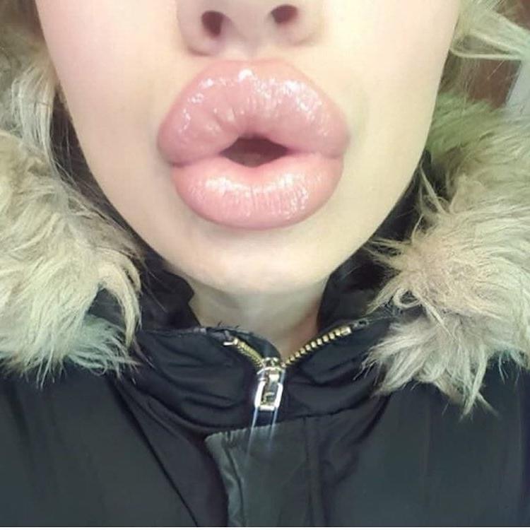 20P Perfect BlowLIPS 001